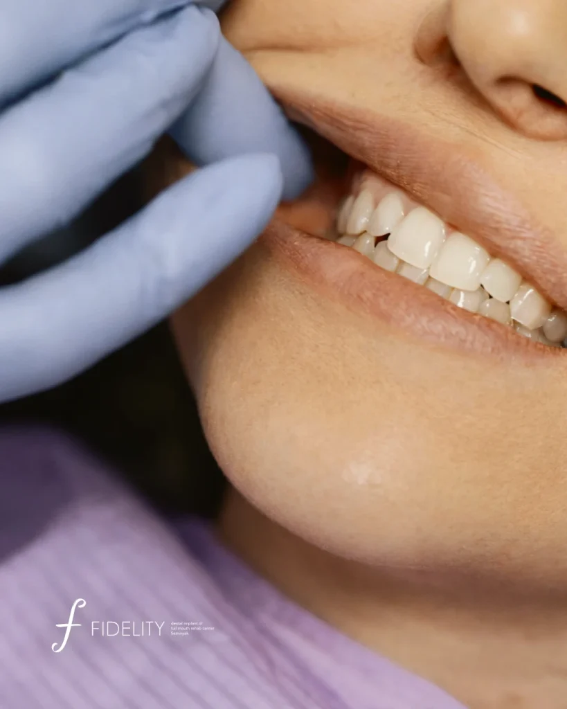 how to treat swollen gums