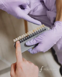 pros and cons of veneers