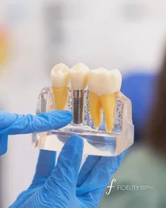 benefits of dental implants